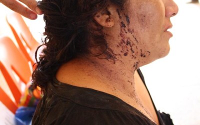 Mujer de Chiapa de Corzo recibe brutal golpiza